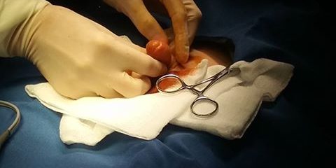 FIMOZA LA COPII- Dr. Klara Bancila