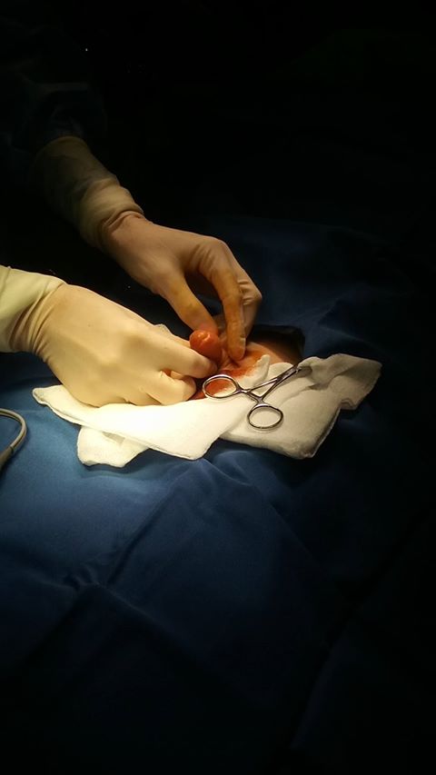 FIMOZA LA COPII- Dr. Klara Bancila FIMOZA LA COPII- Dr. Klara Bancila