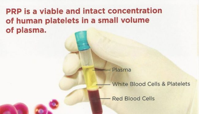 PRICIPIILE BIOLOGICE ALE TERAPIEI CU PRP