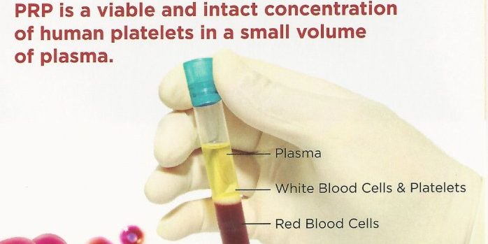 PRICIPIILE BIOLOGICE ALE TERAPIEI CU PRP